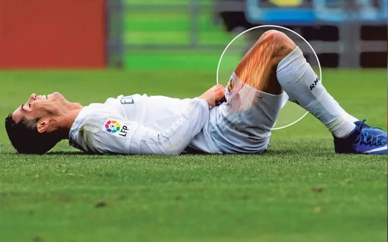 Cristiano Ronaldo Injury History – Real Madrid