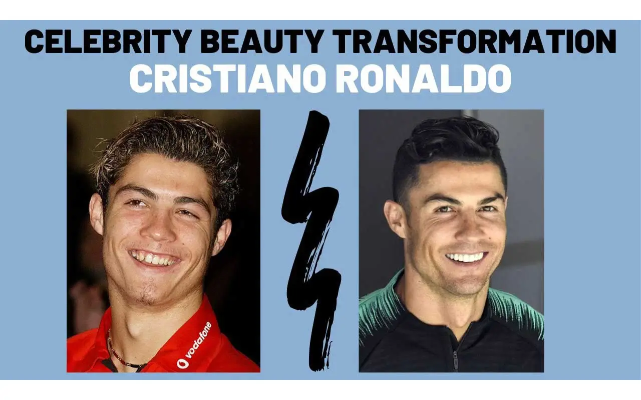 Cristiano Ronaldo Botox